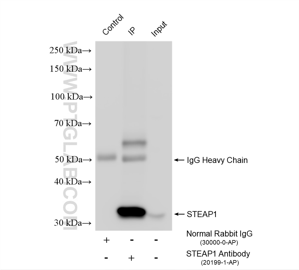 Immunoprecipitation (IP) experiment of LNCaP cells using STEAP1 Polyclonal antibody (20199-1-AP)