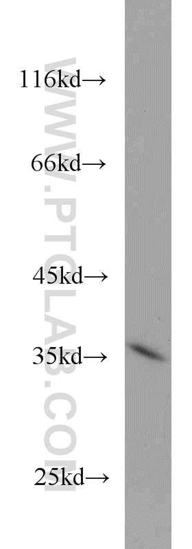 Western Blot (WB) analysis of A431 cells using STEAP1 Polyclonal antibody (20199-1-AP)