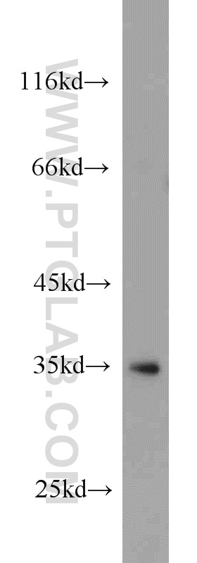 Western Blot (WB) analysis of A431 cells using STEAP1 Polyclonal antibody (20199-1-AP)