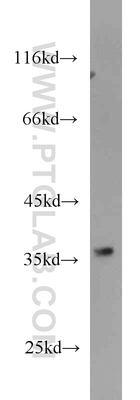 Western Blot (WB) analysis of DU 145 cells using STEAP1 Polyclonal antibody (20199-1-AP)