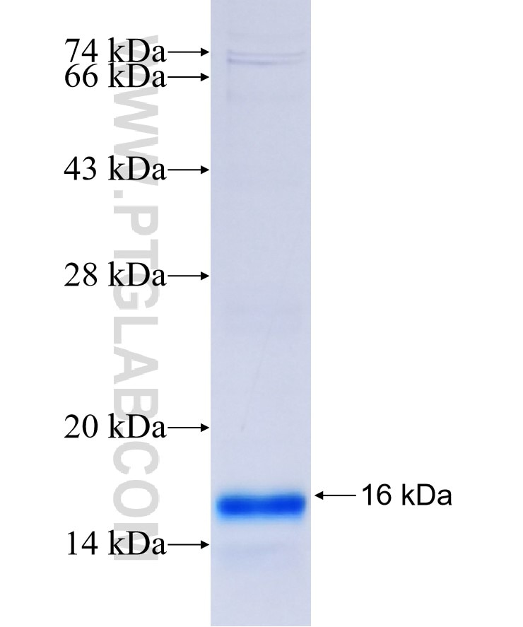 STEAP1 fusion protein Ag14453 SDS-PAGE