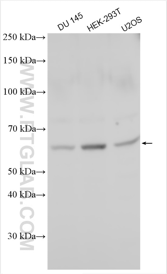 Western Blot (WB) analysis of various lysates using STEAP2 Polyclonal antibody (24804-1-AP)