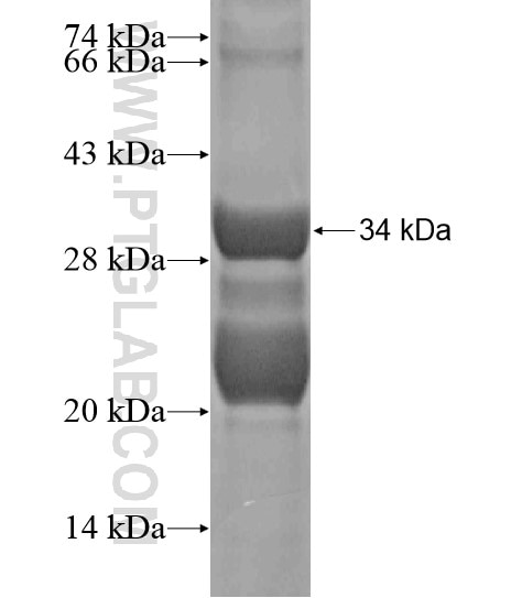 STEAP2 fusion protein Ag20293 SDS-PAGE