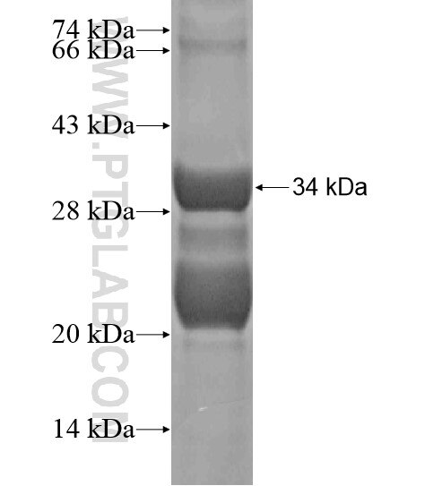 STEAP2 fusion protein Ag20293 SDS-PAGE