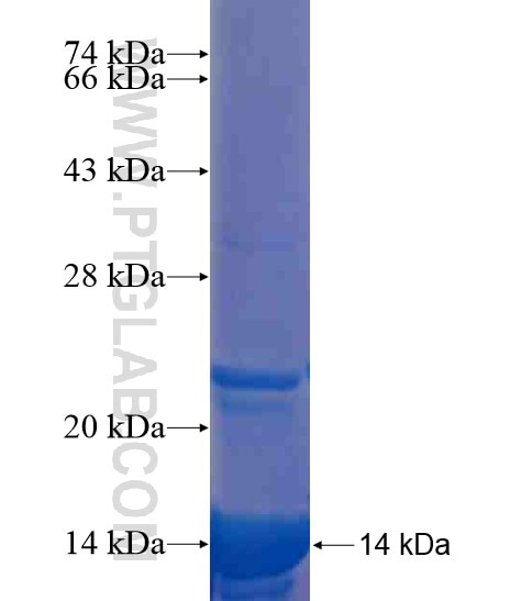 STEAP2 fusion protein Ag20418 SDS-PAGE