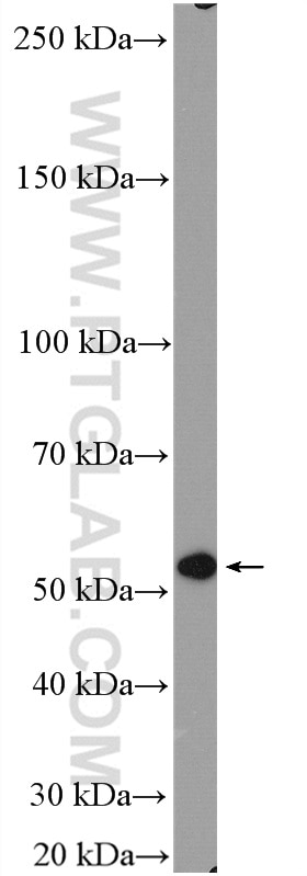 Western Blot (WB) analysis of HEK-293 cells using STEAP2-Specific Polyclonal antibody (20201-1-AP)