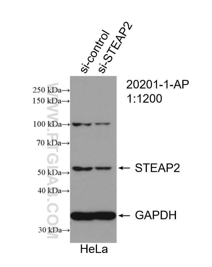Western Blot (WB) analysis of HeLa cells using STEAP2-Specific Polyclonal antibody (20201-1-AP)