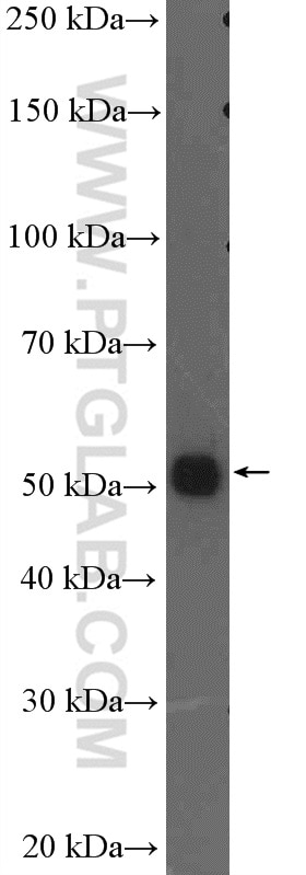 Western Blot (WB) analysis of DU 145 cells using STEAP2-Specific Polyclonal antibody (20201-1-AP)