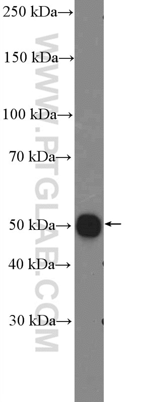 Western Blot (WB) analysis of fetal human brain tissue using STEAP2-Specific Polyclonal antibody (20201-1-AP)