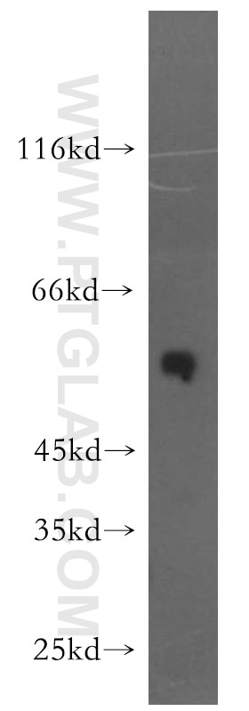 Western Blot (WB) analysis of human brain tissue using STEAP2-Specific Polyclonal antibody (20201-1-AP)