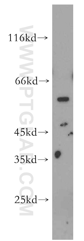 Western Blot (WB) analysis of mouse kidney tissue using STEAP2-Specific Polyclonal antibody (20201-1-AP)