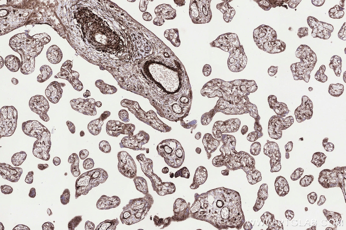 IHC staining of human placenta using 83611-3-RR Immunohistochemistry (IHC) staining of human placenta tissue using STEAP2 Recombinant monoclonal antibody (83611-3-RR)