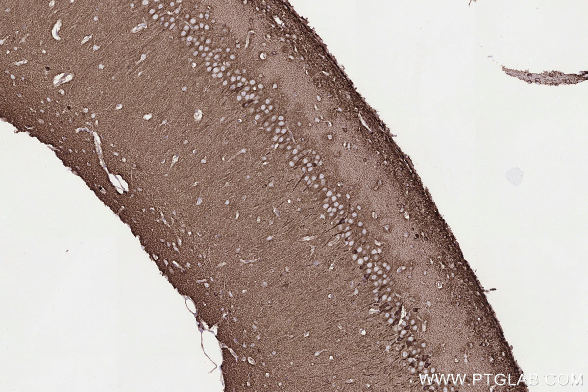 IHC staining of rat brain using 83611-3-RR Immunohistochemistry (IHC) staining of rat brain tissue using STEAP2 Recombinant monoclonal antibody (83611-3-RR)