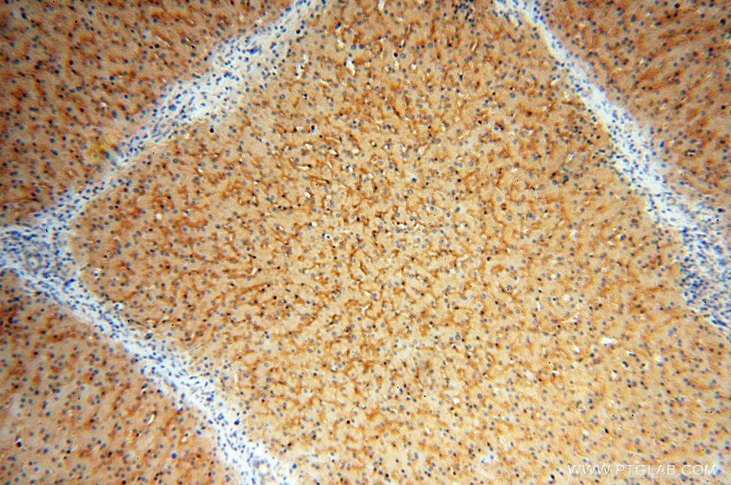 Immunohistochemistry (IHC) staining of human liver tissue using STEAP3 Polyclonal antibody (17186-1-AP)