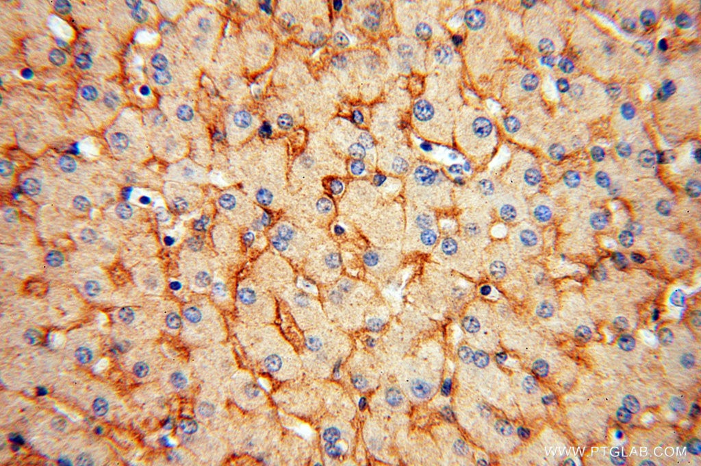 IHC staining of human liver using 17186-1-AP