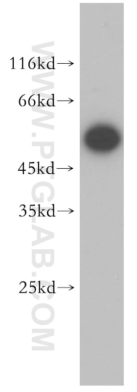 Western Blot (WB) analysis of HepG2 cells using STEAP3 Polyclonal antibody (17186-1-AP)