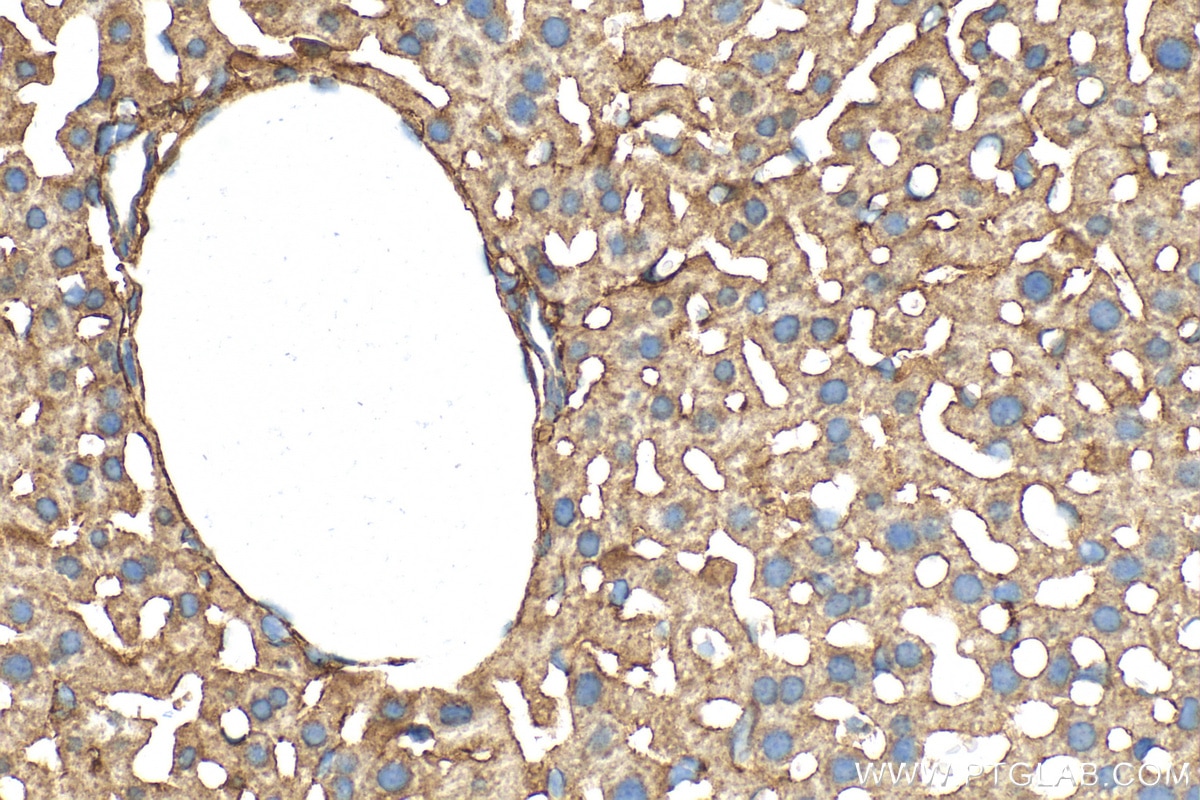Immunohistochemistry (IHC) staining of mouse liver tissue using STEAP3 Polyclonal antibody (28478-1-AP)