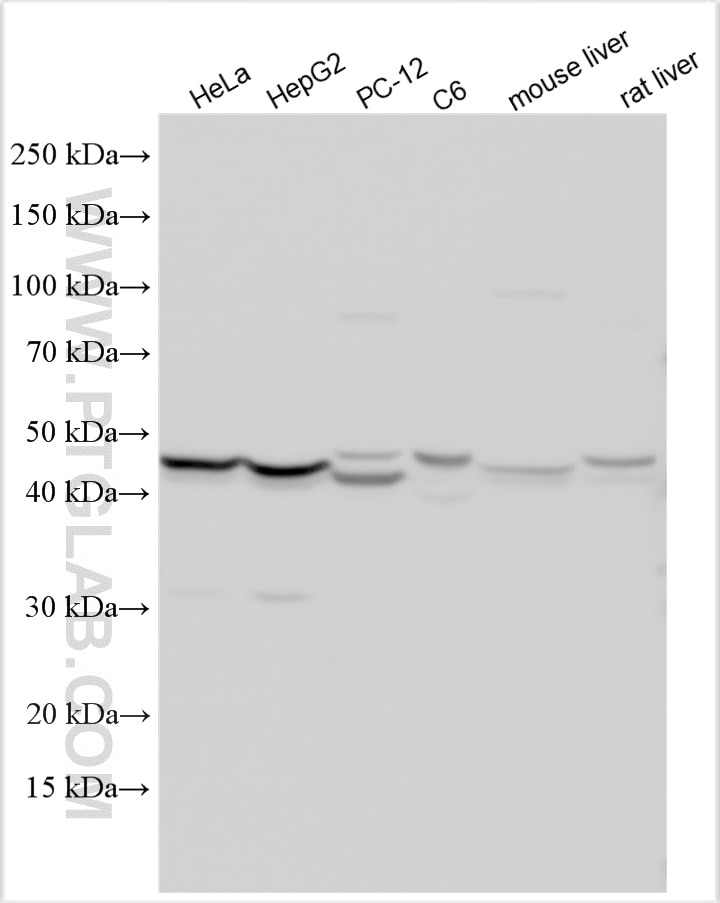 Western Blot (WB) analysis of various lysates using STEAP3 Polyclonal antibody (28478-1-AP)