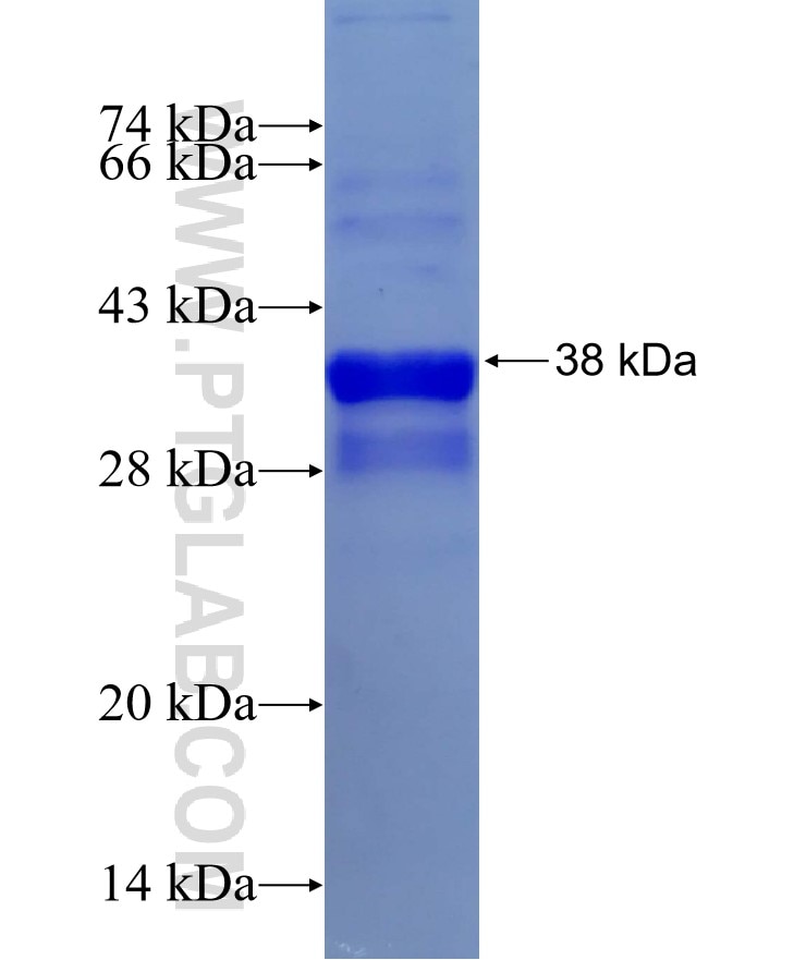 STEAP3 fusion protein Ag29528 SDS-PAGE