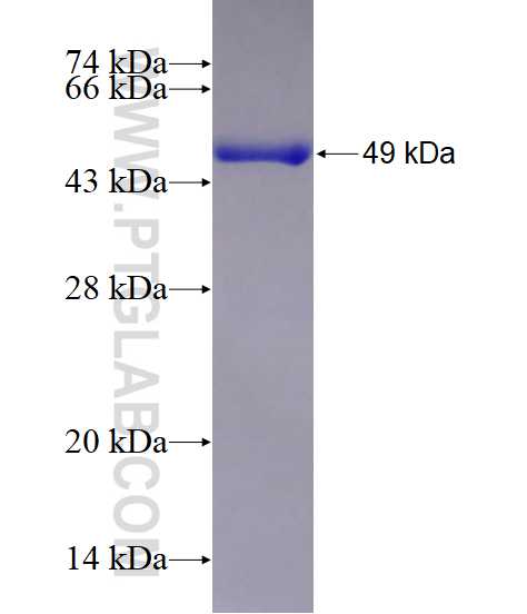 STEAP3 fusion protein Ag10970 SDS-PAGE