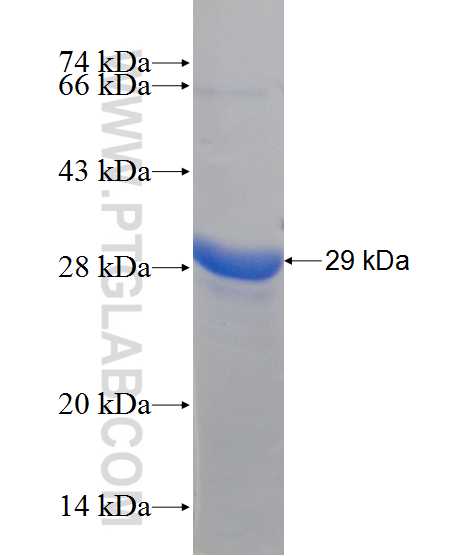 STEAP3 fusion protein Ag11255 SDS-PAGE