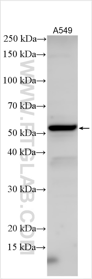 Western Blot (WB) analysis of various lysates using STEAP4 Polyclonal antibody (11944-1-AP)