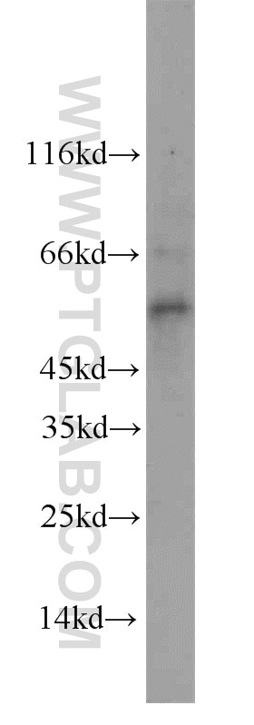 Western Blot (WB) analysis of rat liver tissue using STEAP4 Polyclonal antibody (11944-1-AP)
