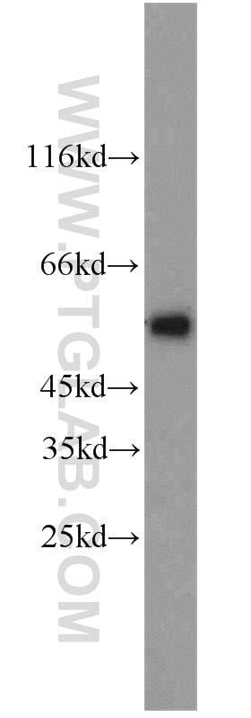 Western Blot (WB) analysis of 3T3-L1 cells using STEAP4 Polyclonal antibody (11944-1-AP)