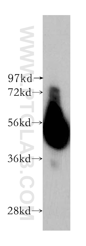 Western Blot (WB) analysis of human liver tissue using STEAP4 Polyclonal antibody (11944-1-AP)