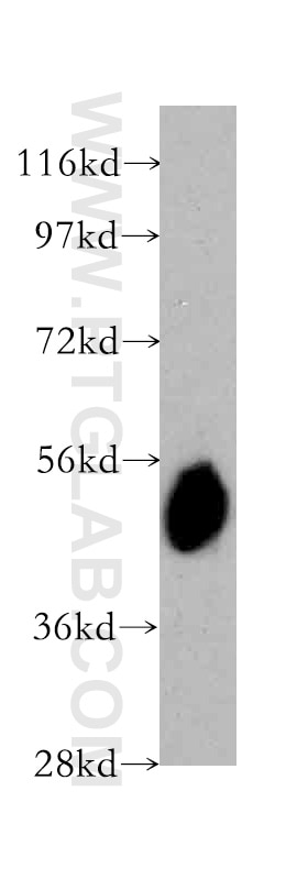 Western Blot (WB) analysis of human brain tissue using STEAP4 Polyclonal antibody (11944-1-AP)
