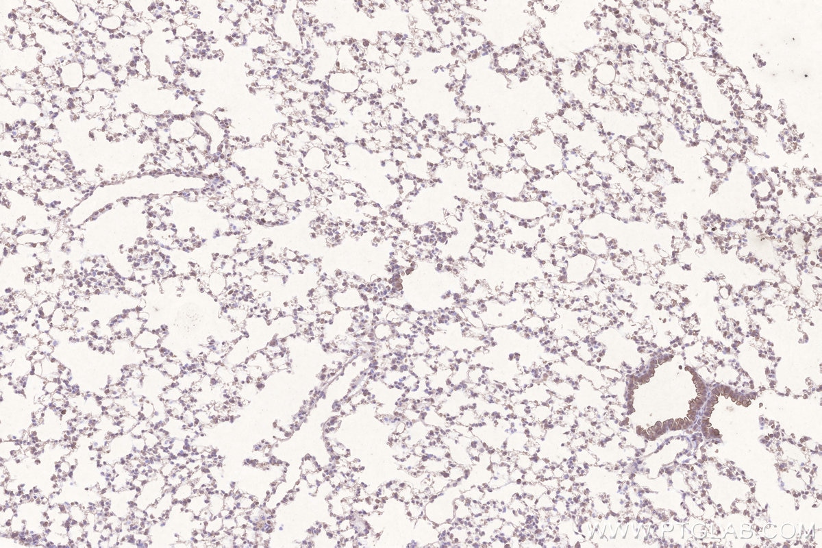 Immunohistochemistry (IHC) staining of mouse lung tissue using STEAP4 Monoclonal antibody (68465-1-Ig)