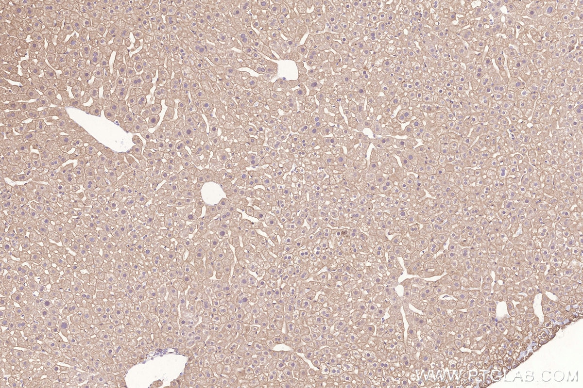 Immunohistochemistry (IHC) staining of mouse liver tissue using STEAP4 Monoclonal antibody (68465-1-Ig)