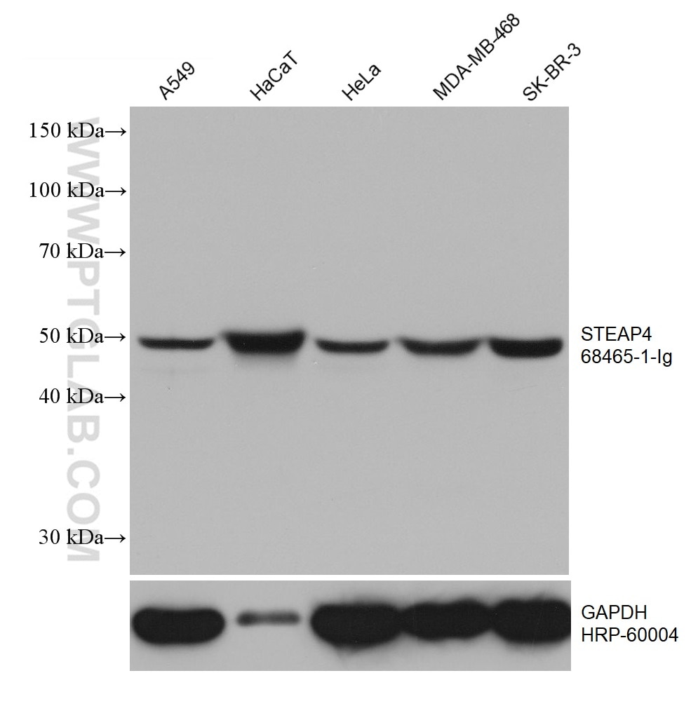 Western Blot (WB) analysis of various lysates using STEAP4 Monoclonal antibody (68465-1-Ig)