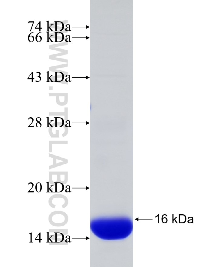 STEAP4 fusion protein Ag30137 SDS-PAGE