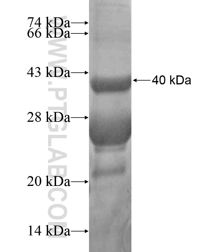 STH fusion protein Ag17541 SDS-PAGE