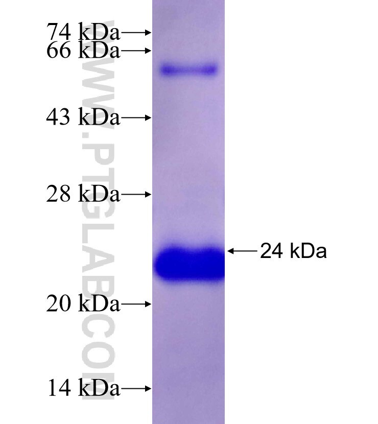 STIJA fusion protein Ag26946 SDS-PAGE STIJA fusion protein Ag26946 SDS-PAGE