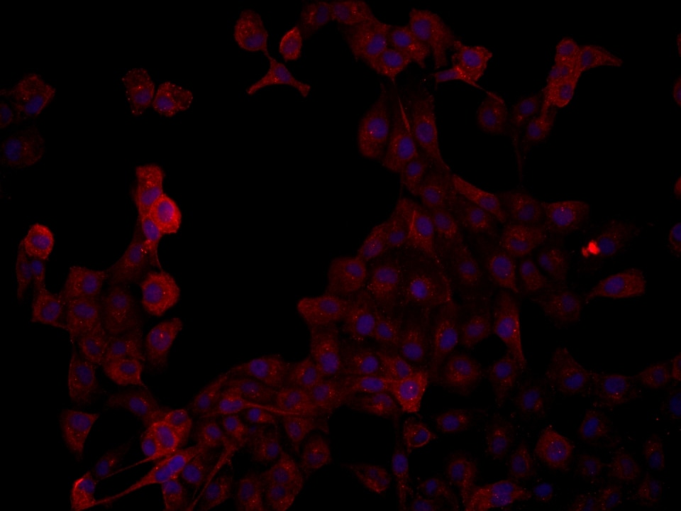 Immunofluorescence (IF) / fluorescent staining of A431 cells using STIL Monoclonal antibody (66876-1-Ig)