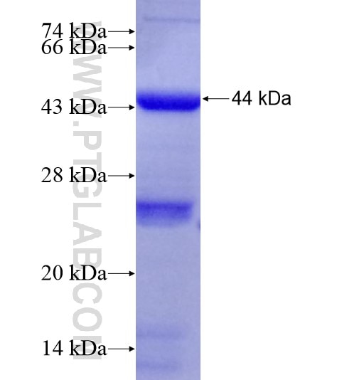 STIL fusion protein Ag19124 SDS-PAGE