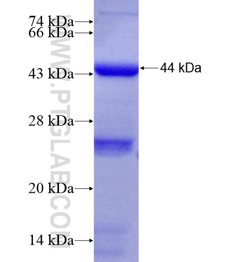 STIL fusion protein Ag19124 SDS-PAGE