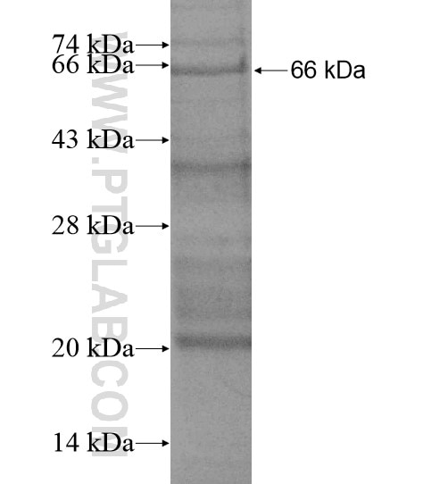 STIL fusion protein Ag19501 SDS-PAGE