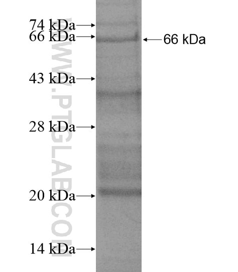 STIL fusion protein Ag19501 SDS-PAGE