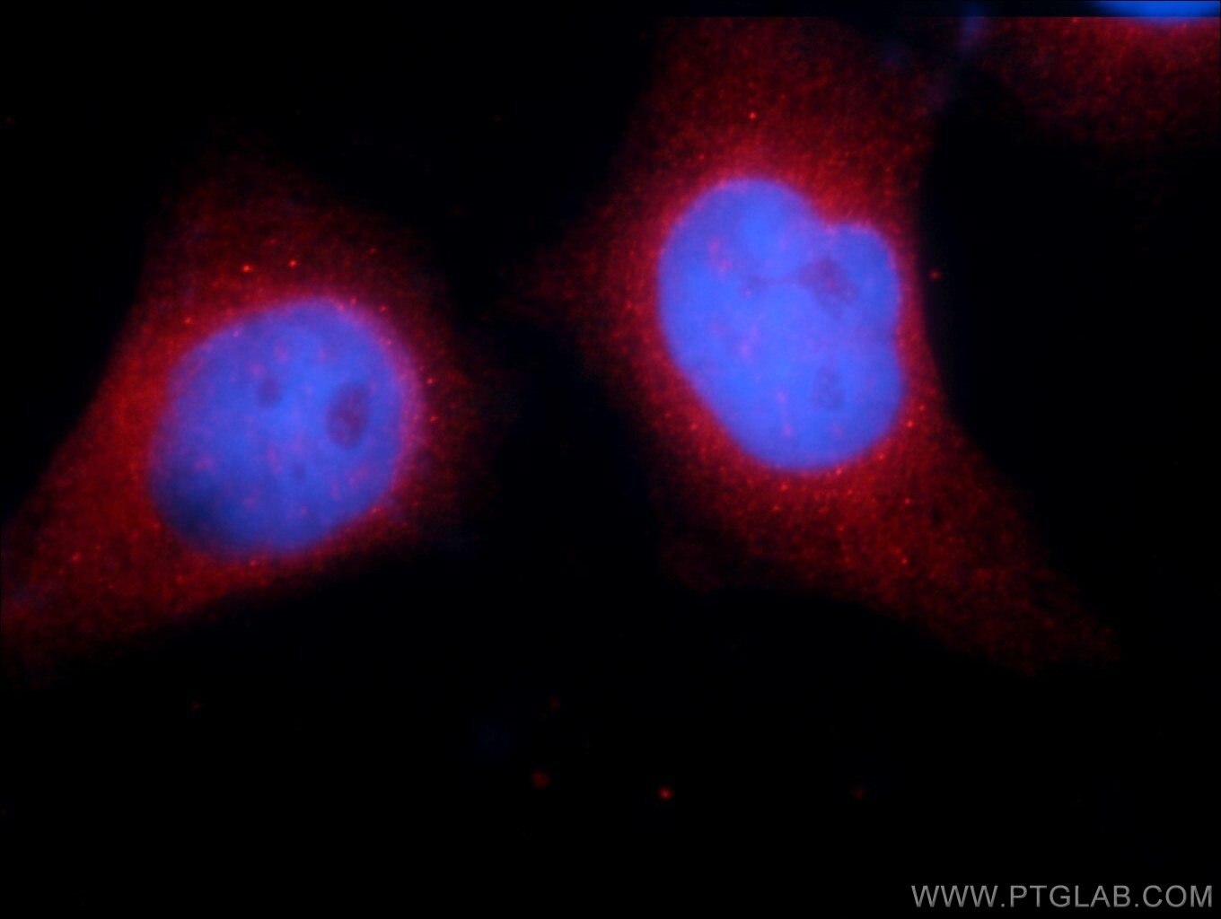 STIM1 Polyclonal antibody