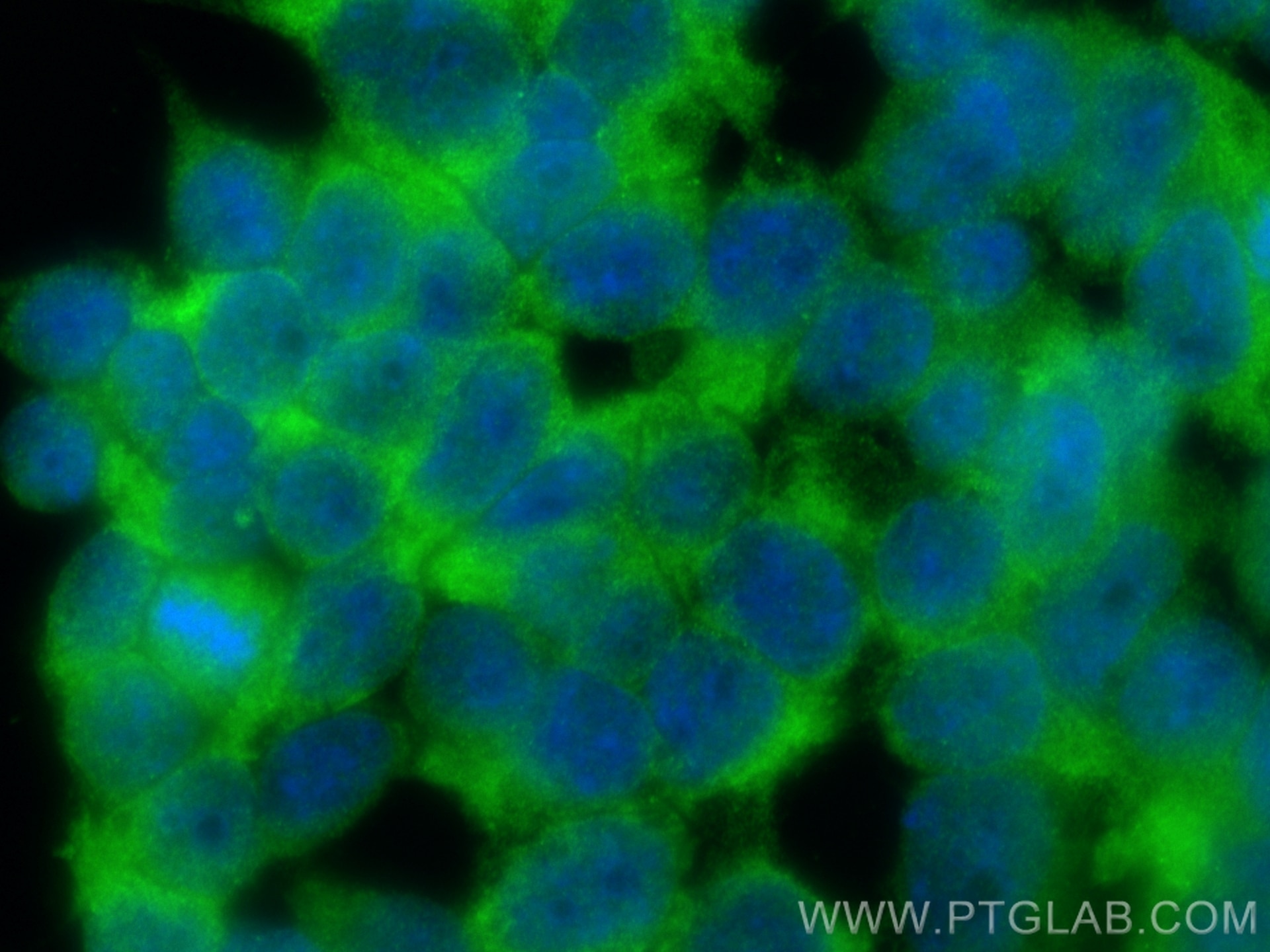 Immunofluorescence (IF) / fluorescent staining of HEK-293 cells using STIM1 Polyclonal antibody (11565-1-AP)