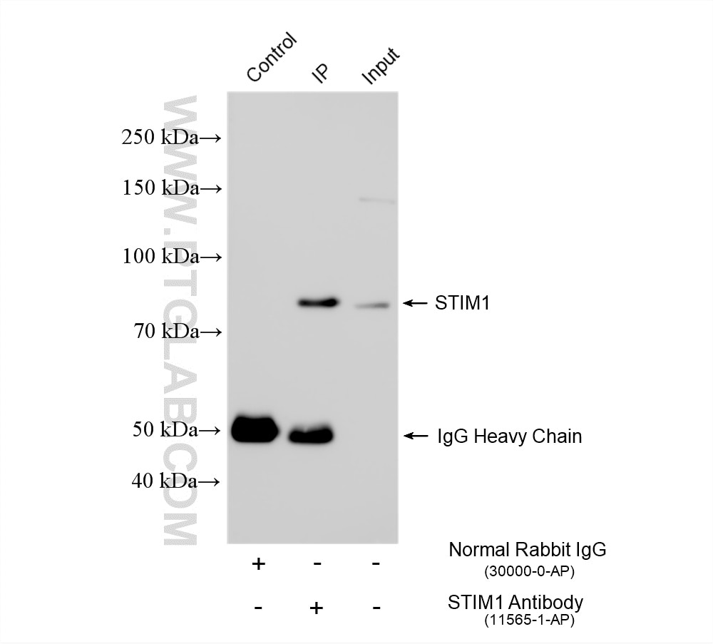 Immunoprecipitation (IP) experiment of HeLa cells using STIM1 Polyclonal antibody (11565-1-AP)