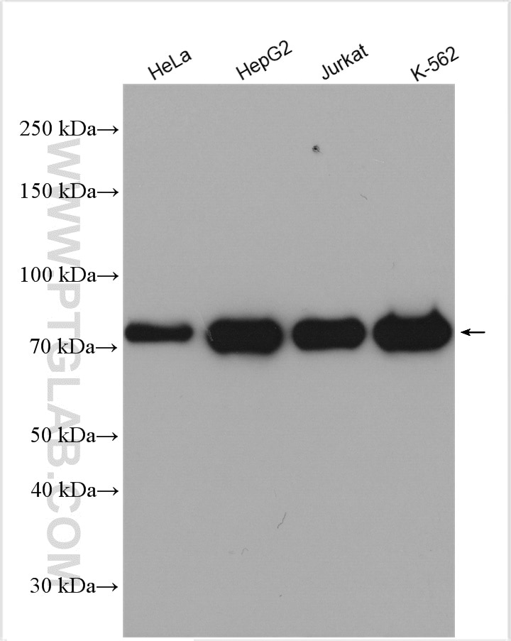 Western Blot (WB) analysis of various lysates using STIM1 Polyclonal antibody (11565-1-AP)