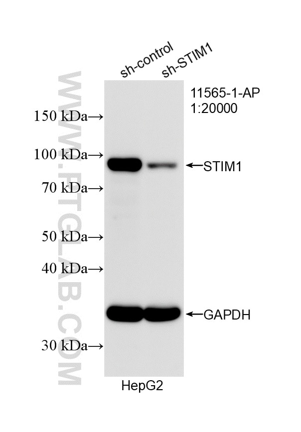 WB analysis of HepG2 using 11565-1-AP Western Blot (WB) analysis of HepG2 cells using STIM1 Polyclonal antibody (11565-1-AP)