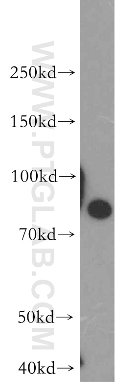 STIM1 Polyclonal antibody