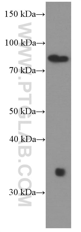 Western Blot (WB) analysis of Jurkat cells using STIM1 Monoclonal antibody (66189-1-Ig)