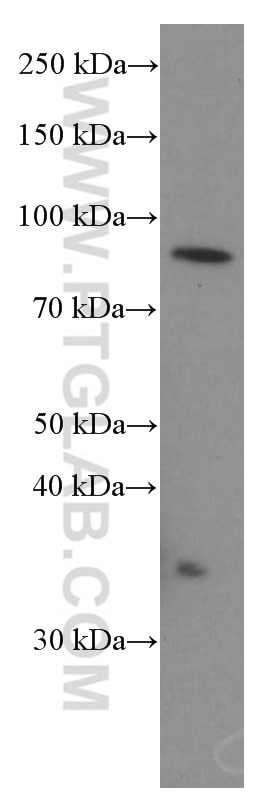 STIM1 Monoclonal antibody