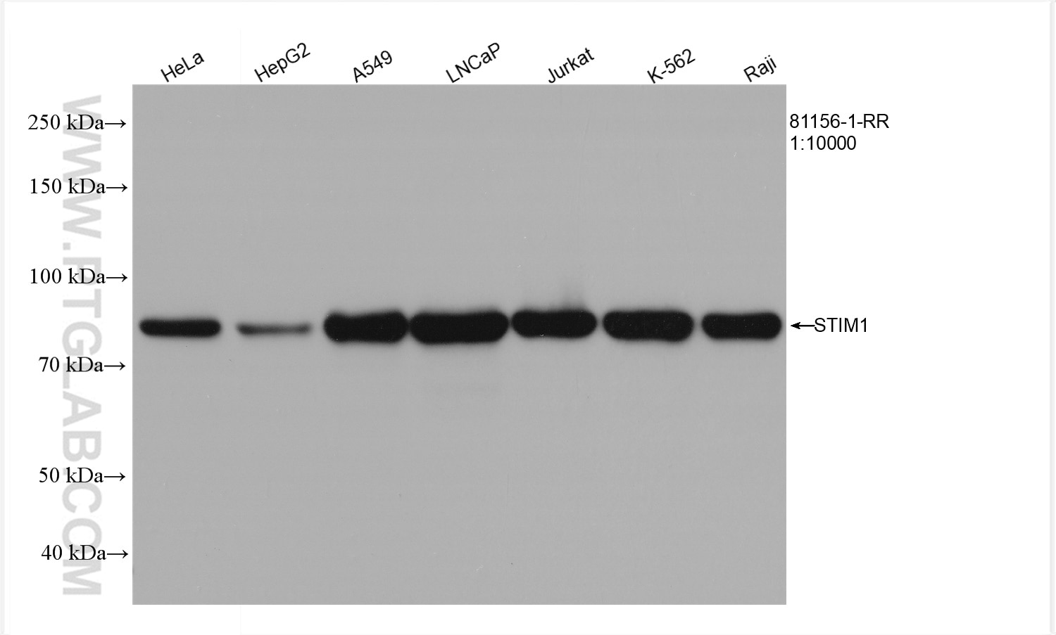 Western Blot (WB) analysis of various lysates using STIM1 Recombinant antibody (81156-1-RR)